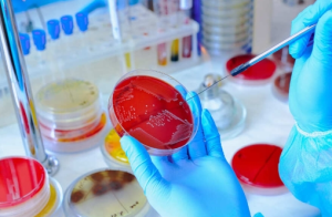 En Laboratorio | tamizaje enlaboratorio |